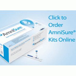 AmniSure® ROM Test - box of 10 tests AmniSure® ROM Test - box of 10 tests
