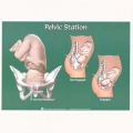 PELVIC STATION CHART