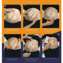 ANTENATAL CHECK CHART